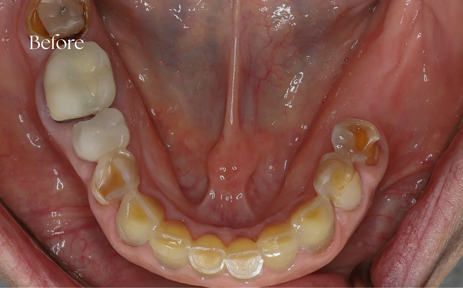 صورة ما قبل العلاج — case-004