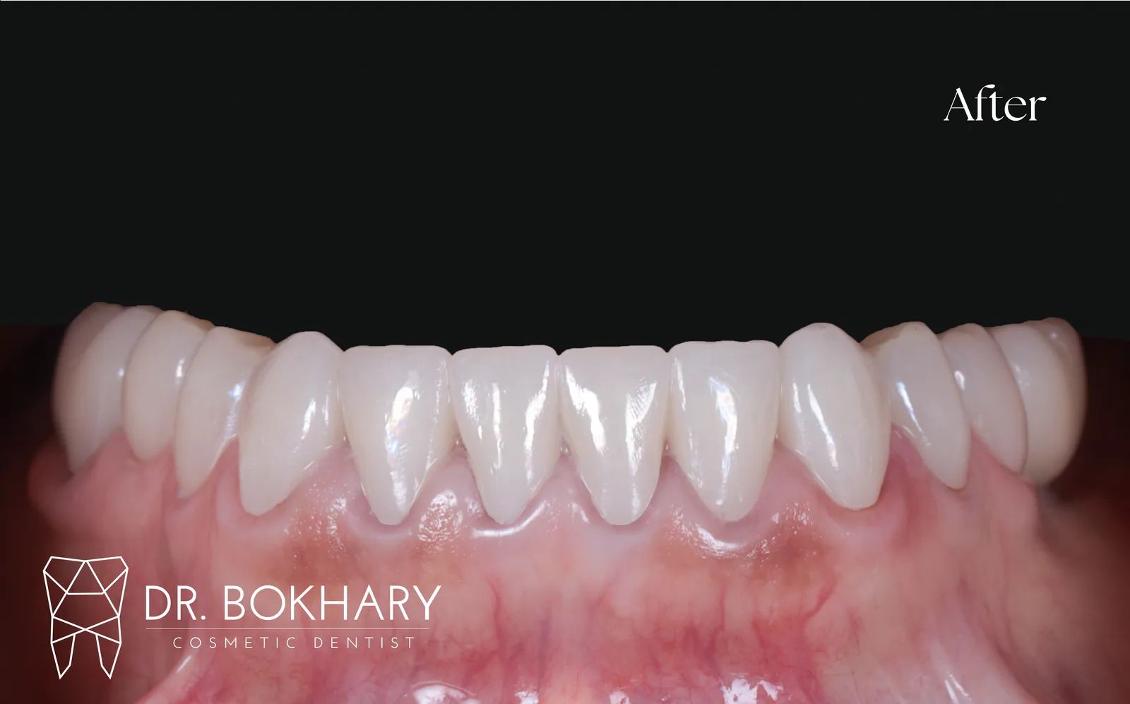 صورة ما بعد العلاج — case-005